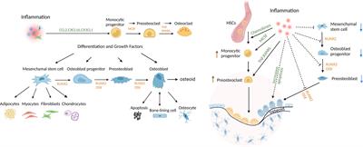 Impact of the host response and osteoblast lineage cells on periodontal disease